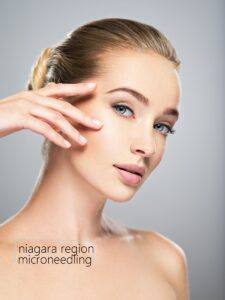 Niagara Falls microneedling